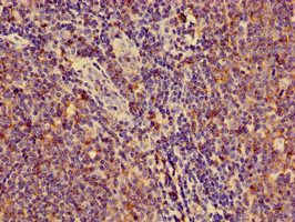 HLA-C Antibody