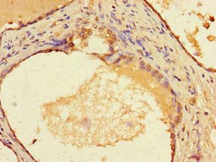 HLA-DMA Antibody