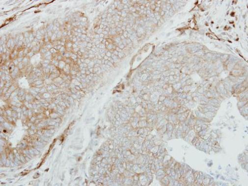 HLA-DMB Rabbit Polyclonal Antibody