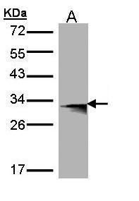 HLA-DMB Rabbit Polyclonal Antibody