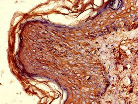 HLA-DQB1 Antibody