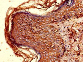 HLA-DQB1 antibody