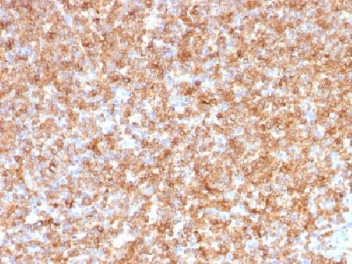 HLA-DR antibody