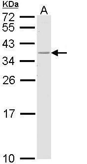 HLA-DR beta antibody