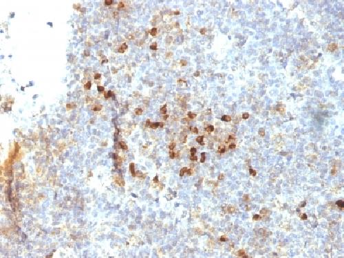 HLA-DRA Antibody