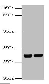 HLA-DRB1 antibody