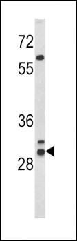 HLA-DRB1 antibody