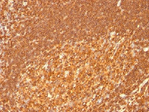 HLA-DRB (MHC II) Antibody