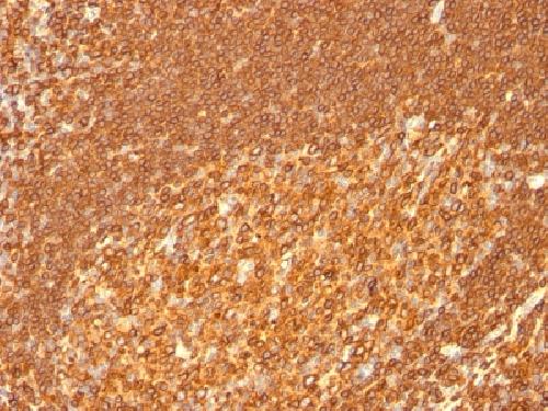 HLA-DRB1 antibody