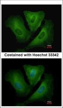 PSMA6 antibody