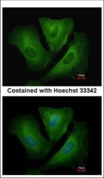 proteasome subunit alpha 6 Antibody