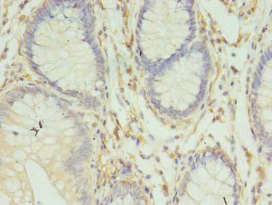 HLA-DRB4 Antibody