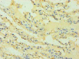 HLA-G Antibody