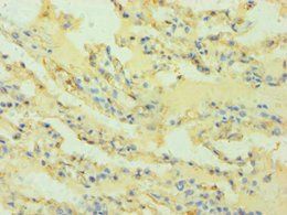 HLA-G antibody