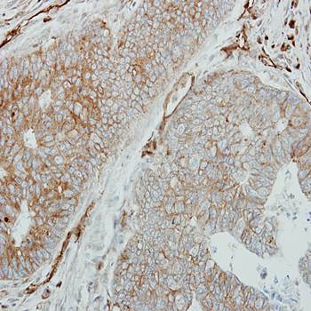 HLA-DMB antibody