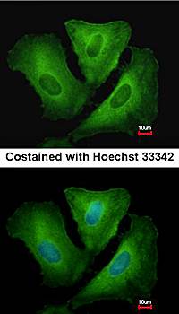 HLA-DRB3 antibody