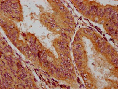 HLCS Antibody