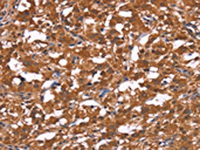 HLTF Antibody