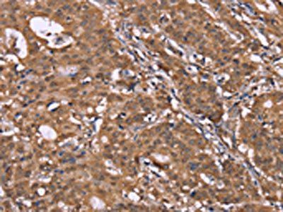 HLTF Antibody