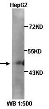HLX1 Rabbit Polyclonal Antibody