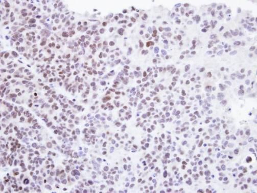 HMBOX1 antibody [N3C3]