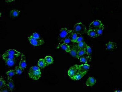 HMBS Antibody