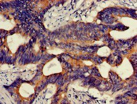 HMBS Antibody
