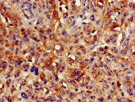 HMBS Antibody