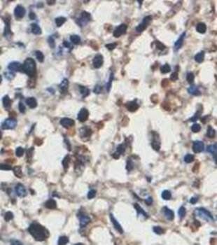 HMG20A Rabbit Polyclonal Antibody