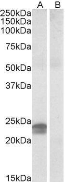HMGA1 (aa9-21) Antibody
