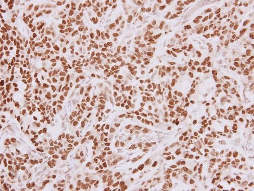HMGA2 antibody - ChIP grade