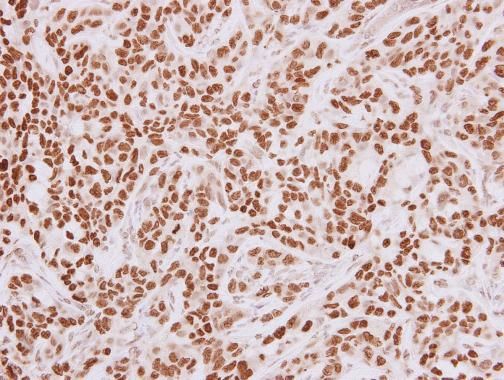 HMGA2 antibody