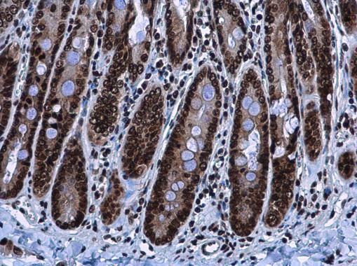 HMGA2 antibody - ChIP grade
