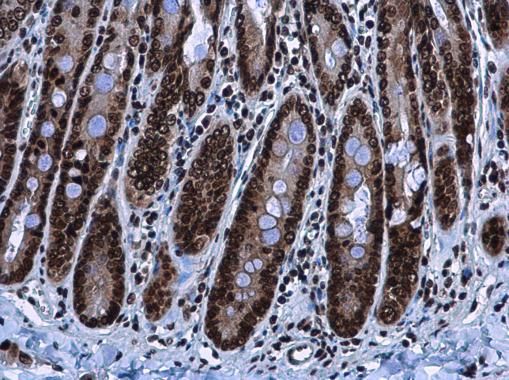 HMGA2 antibody