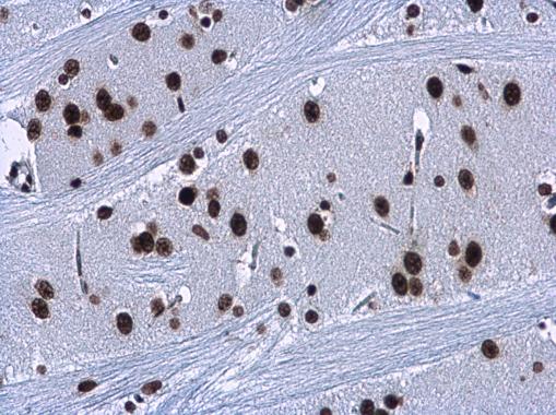 HMGA2 antibody - ChIP grade