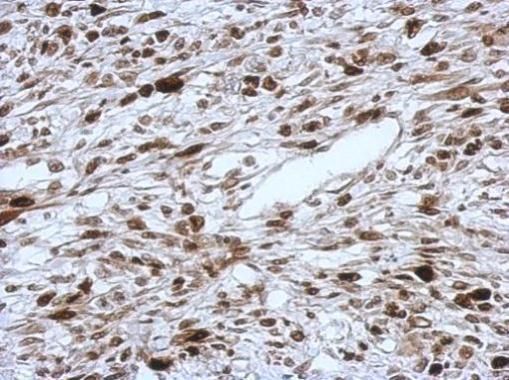 HMGA2 antibody - ChIP grade