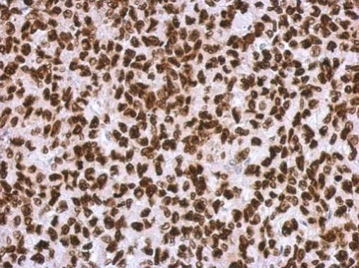 HMGA2 antibody - ChIP grade