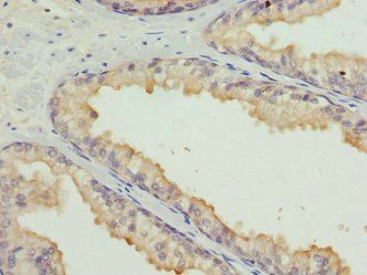 HMGB1 Antibody