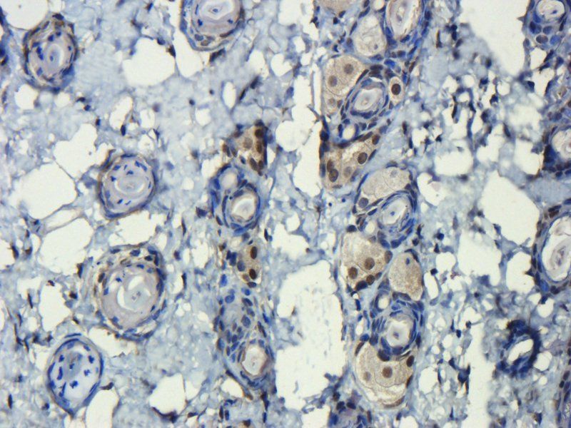 HMGB1 antibody