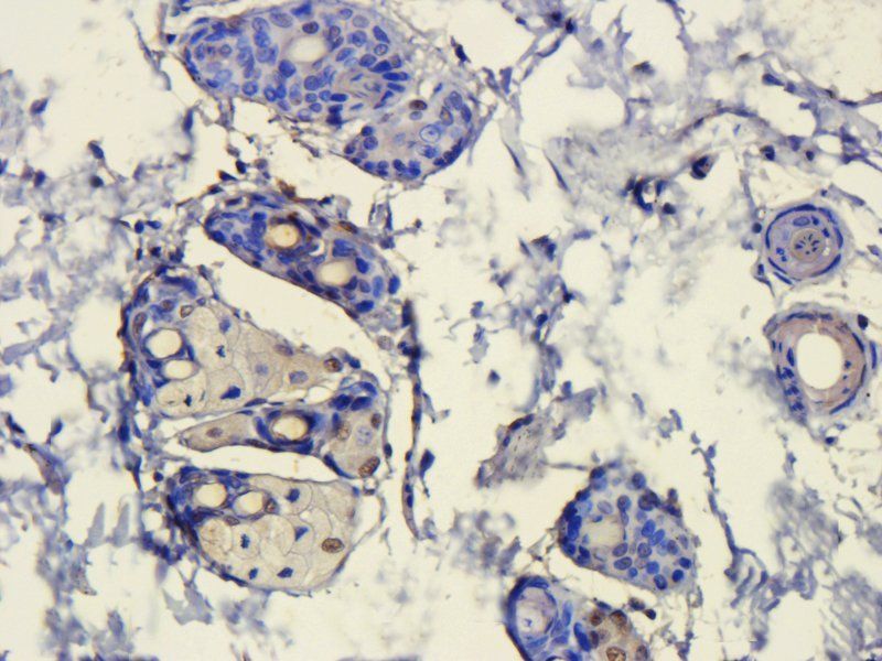 HMGB1 antibody