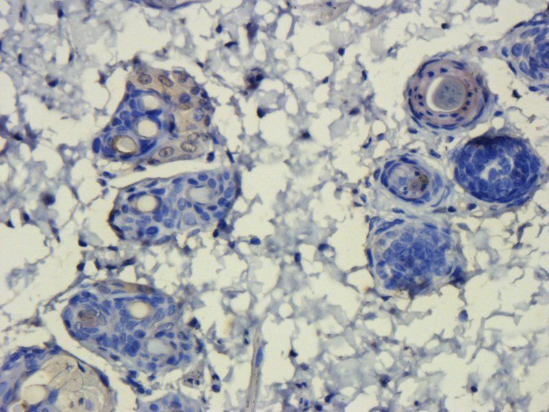 HMGB1 antibody