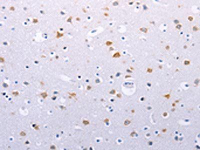 HMGB3 Antibody