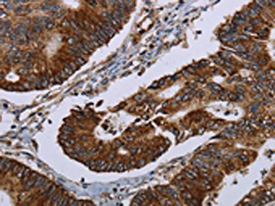 HMGCR Antibody