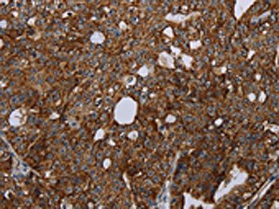 HMGCR Antibody