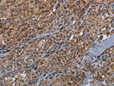 HMGCR Antibody