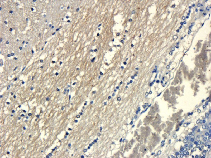 HMGCR (phospho-Ser872) antibody