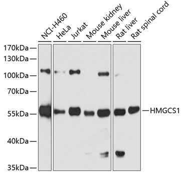 HMGCS1 antibody