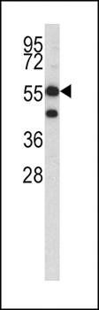 HMGCS1 antibody