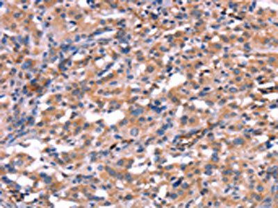HMGCS1 Antibody