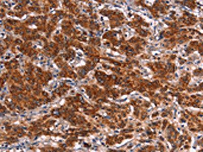 HMGCS2 antibody